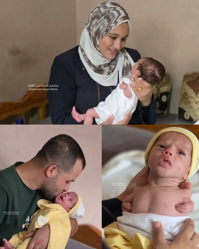 نور ولدت بلا يدين… وهي أول فرحة لأمّها