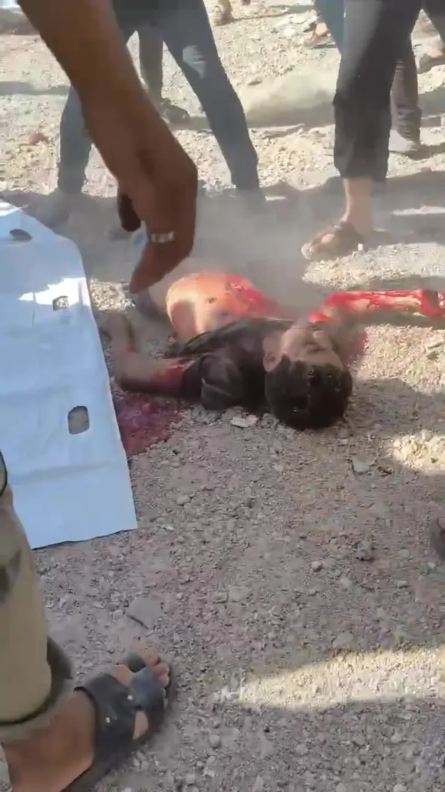 The child of Mohammed Abd al-Zeinati, who was killed in a strike targeting a group of citizens in Third Street in the Sheikh Radwan neighborhood, northwest of Gaza City