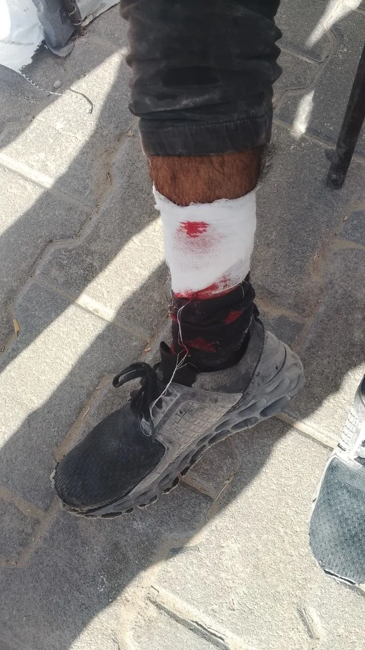 Un joven resulta herido por un disparo en el pie en el barrio holandés, al oeste de Jan Yunis, al sur de la Franja de Gaza — Imagen 1