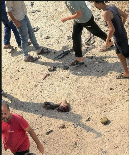 يد أحد الشهداء جراء الاستهداف طائرة مسيّرة إسرائيلية لمركبة بالقرب من مقر الإذاعة والتلفزيون في حي تل الهوا جنوب غربي مدينة غزة.
